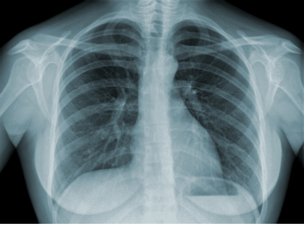 Radon: pericolo invisibile